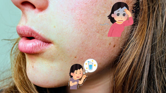 Comment reconnaître une peau qui manque d'hydratation ?